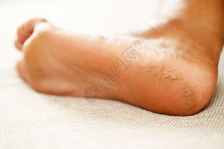 脚霜应定期施用按摩高跟鞋使奶油吸收水井帮助将分添加到脚皮上b提高水分腿应用干燥图片