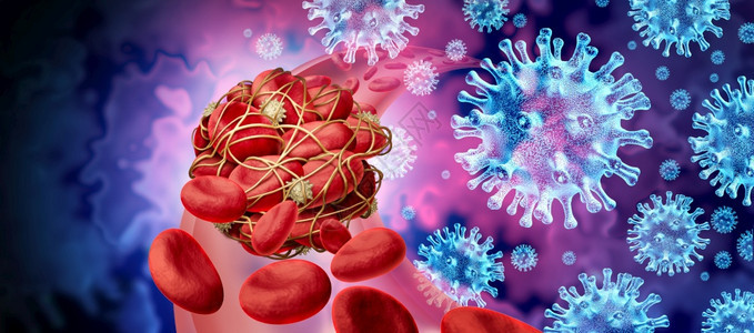 血凝块和感染以及科罗纳或流感作为细胞被粘黏的小板挤在一起纤维剂作为动脉或血管堵塞物阻排成三维转化的氯丁基致命健康血栓图片