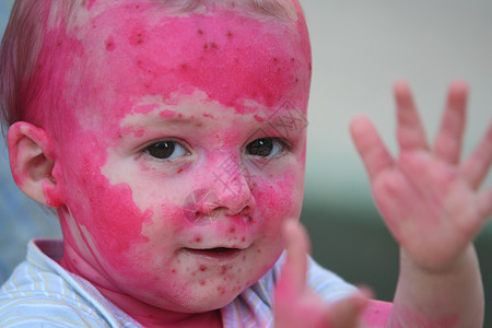 儿童申诉皮肤疾病男生童年婴儿图片