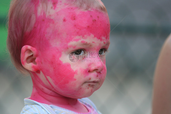 儿童申诉皮肤男生疾病童年婴儿图片