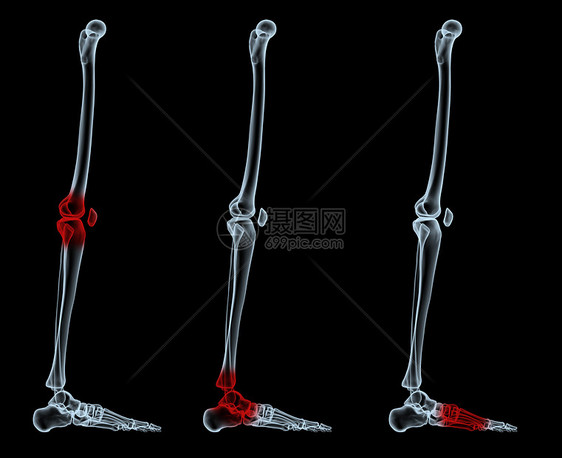 x射线生物学医疗病人骨骼放射科x光解剖学脊椎动物图片