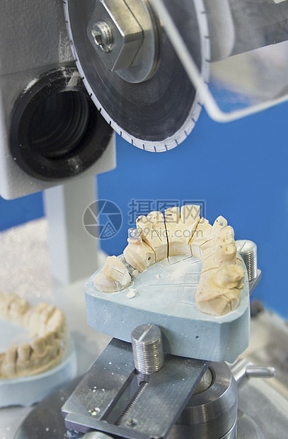 牙科设备假牙陶瓷质量作坊乐器技术白色金属药品齿轮图片