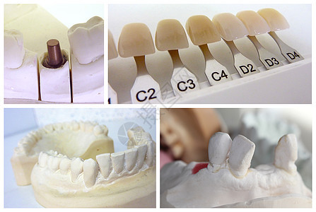 牙科技术员物体图片
