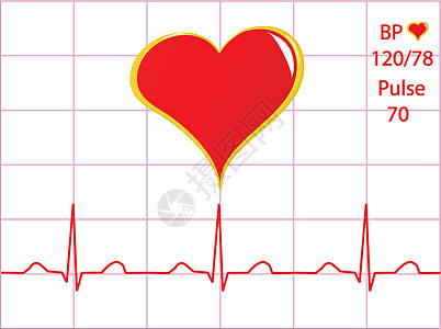 健康心脏插图 带有心脏痕迹展示诊所死亡疾病海浪波浪频率病学情况考试图片