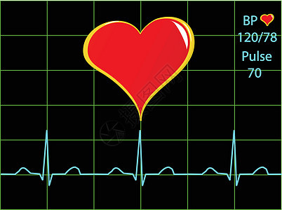 健康心脏插图 带有心脏痕迹死亡情况诊所波浪展示监视器药品考试电气生活图片