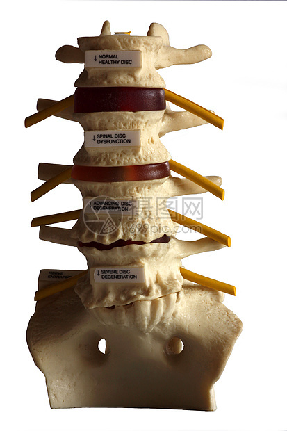 脊柱光盘疾病脊椎姿势医生椎骨解剖学诊所医师神经图片