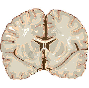 白上孤立的人类大脑想像力风暴科学绘画学校保健沉思药品力量花瓣图片