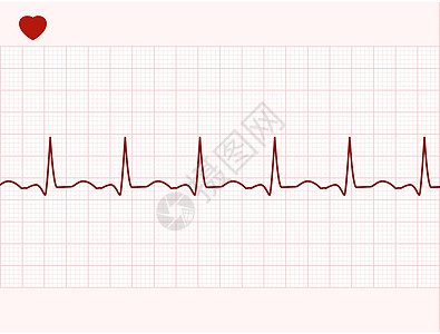普通电子心电图EPS 8诊所疾病医院仪表药品脉冲插图屏幕红色科学图片