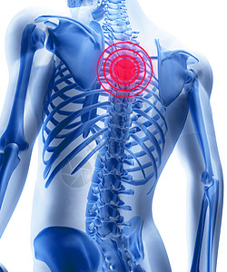 男人的骨质骨骼 有主心结骨疼痛症的人红色肋骨疼痛中心科学髂骨身体脊椎脊柱风湿病图片