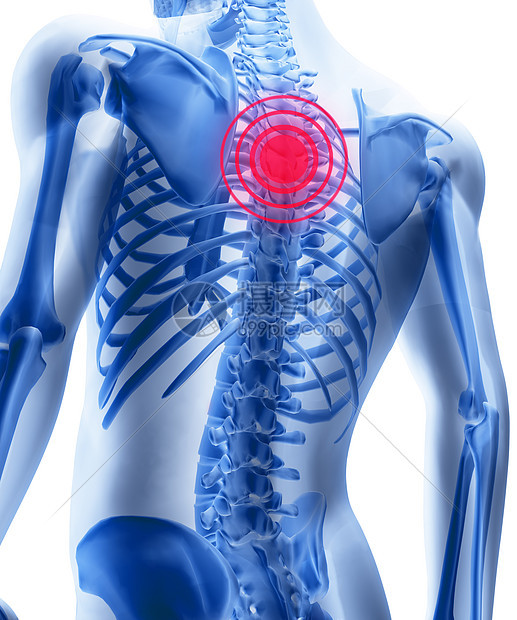 男人的骨质骨骼 有主心结骨疼痛症的人红色肋骨疼痛中心科学髂骨身体脊椎脊柱风湿病图片