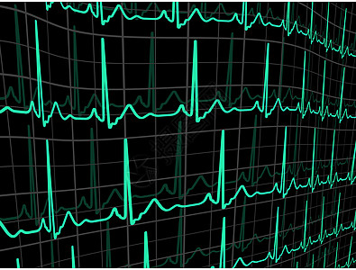 黑监视器上的心跳 EPS 8图片