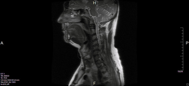 磁共振成像系列颈椎病核磁共振神经元健康辐射器官乐队肌肉麝香药品图片