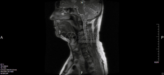 磁共振成像系列颈椎病核磁共振神经元健康辐射器官乐队肌肉麝香药品图片