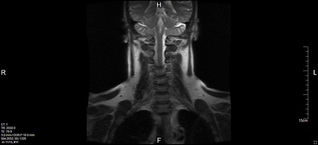 磁共振成像系列核磁共振乐队药品身体器官辐射颈椎病麝香黑色脖子图片