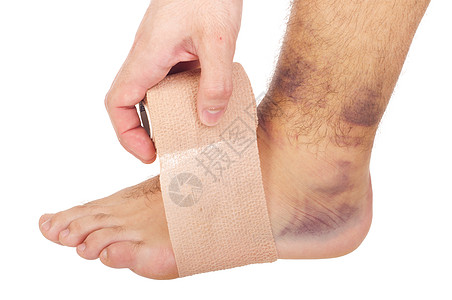 扭扭脚踝赤脚男人包扎机动性松紧带绷带肌肉治疗创伤血肿图片
