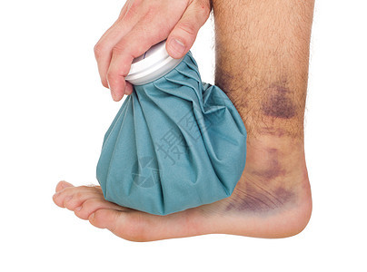 扭伤脚踝痛苦伤口血肿保健运动员疼痛创伤药品蓝色卫生图片