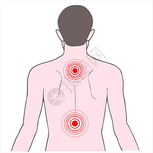 背部和颈痛图片