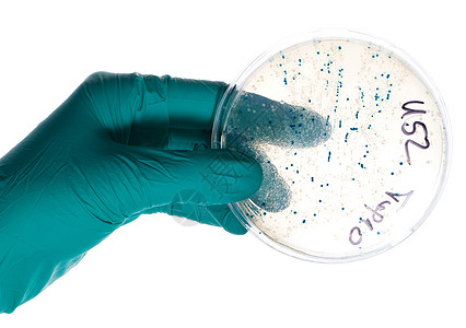 硝基手套手持Petri盘子和细菌菌群菌落科学大肠杆菌克隆塑料身体公司实验基因细菌图片