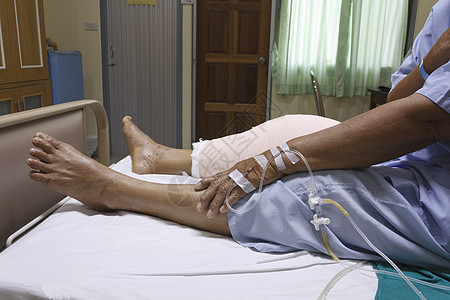 替代膝盖的切口人类骨科外科医院保健医疗医学病房手术设备图片