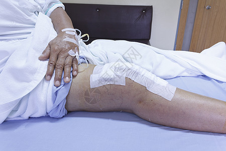 替代膝盖的切口外科残疾人疾病人类设备医疗骨科医院病房女性图片