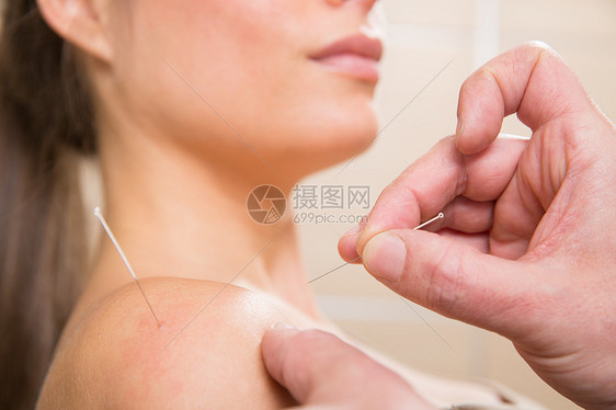 医生亲手针缝针针刺女人女士愈合治疗治愈幸福肩膀女性温泉福利临床图片
