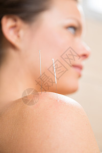 针缝针刺在妇女肩上女孩病人休息皮肤技术压力女性针灸师药品女士图片
