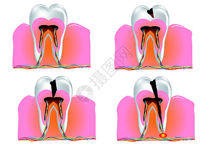 牙牙齿结构图片