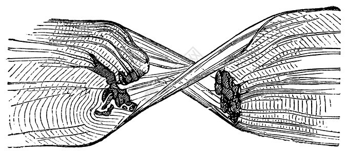 撕破的肌肉纤维 刻有古代文字的插图条纹身体肌腱解剖学骨骼绘画蚀刻肌纤维白色胶原图片