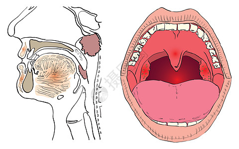 亚丁类绘画嘴唇插图鼻子治疗数字损失舌头牙齿药品图片