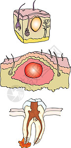 崩溃病痛数字卫生疾病过程药品生长绘画牙齿皮肤图片