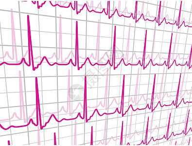 心脏跳过心心动图 EPS 8图片
