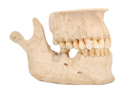 人的下巴树桩石膏口腔科臼齿卫生牙医宏观保健实验室牙齿图片