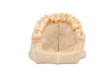 上下巴骨牙医卫生王冠牙科臼齿牙周树桩牙疼石膏口腔科图片