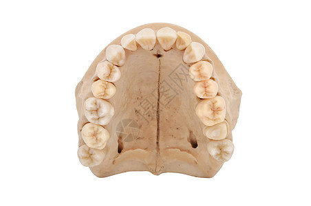 上下巴骨卫生王冠假肢树桩牙周牙医牙科臼齿牙齿口腔科图片