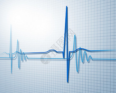 音速图像韵律诊断疾病海浪医院网格图表死亡药品病人图片