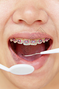 牙科概念保健青少年女性女孩矫正宏观医学牙齿微笑女孩们图片