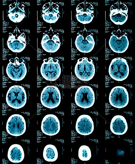 成人脑X光片保健射线药品医疗生活照相x光医学工作背景图片