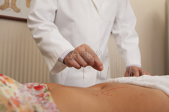 插入针缝针生活方式福利腹部考试部位保健人体混血衬衫裙子图片