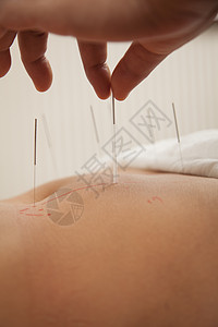 插入针缝针考试医生摄影人体人类女性保健定位腹部混血图片