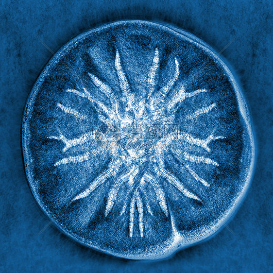模糊模子的大型X光拍摄细菌殖民地技术孢子生长科学生活生物文化生物学图片