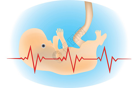 电图孩子心电图健康监控胚胎夹子早产儿生存早产海浪图片