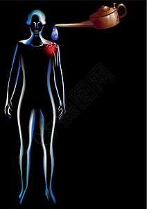 肩部疼痛生物学肩膀x光手臂解剖学黑色医疗躯干风湿病科学图片