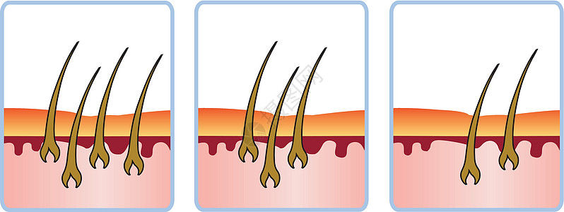 毛发增长周期图片