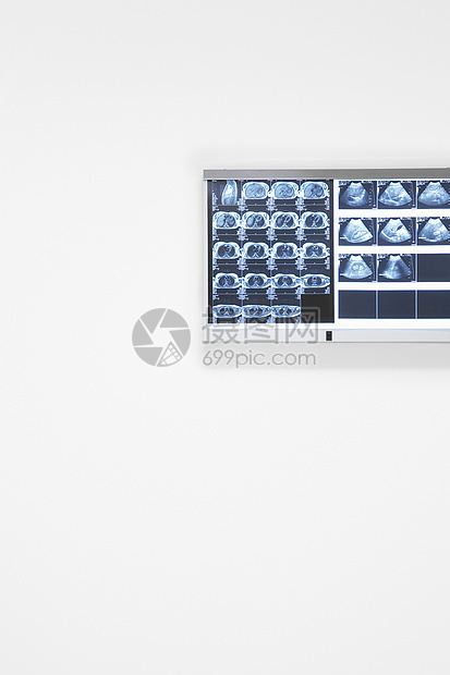 挂在墙上的X光和超声效果医学医疗保健x光医院科学超声波图片