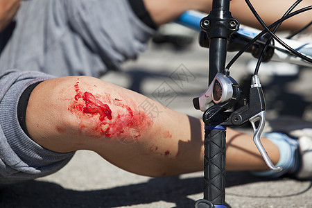 自行车跌伤身体创伤瘢痕考试舞台妆痛苦疼痛交通保健伤口图片