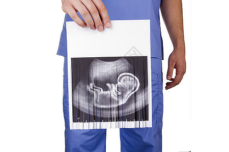禁止堕胎孩子医生长子胎儿产科插图身体禁令腹部怀孕图片