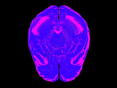 3D人脑知识分子智力保健生物学风暴科学医疗感官分层裂片图片
