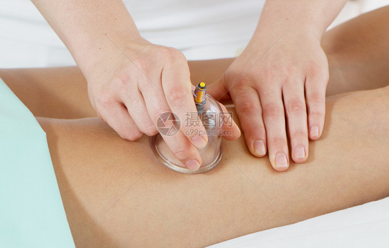 脚按摩温泉组织真空沙龙治疗患者纤维素按摩师药品橘皮图片