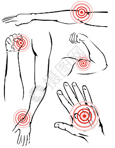 手臂疼痛病人脚痛断臂解剖学半径肩膀软骨压力愈合身体图片