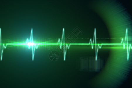 黑色和绿色的ECG线计算机波形心电图监视器电极绘图图片